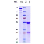 SDS-PAGE - Anti-TYRO3 Antibody [ELB031] - Low endotoxin, Azide free (A324286) - Antibodies.com