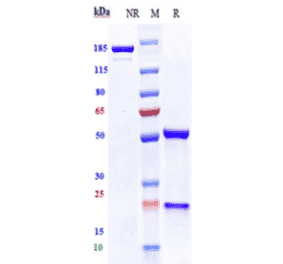 SDS-PAGE - Anti-VEGF Receptor 2 Antibody [Research Grade Biosimilar] - Low endotoxin, Azide free (A324289) - Antibodies.com