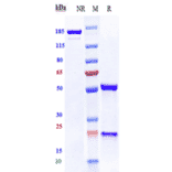 SDS-PAGE - Anti-VEGF Receptor 2 Antibody [Research Grade Biosimilar] - Low endotoxin, Azide free (A324289) - Antibodies.com