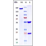 SDS-PAGE - Anti-VEGF Receptor 2 Antibody [AT001] - Low endotoxin, Azide free (A324290) - Antibodies.com