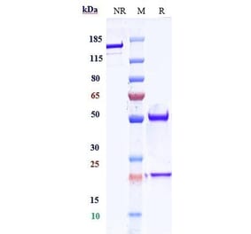 SDS-PAGE - Anti-VEGFA Antibody [Research Grade Biosimilar] - Low endotoxin, Azide free (A324292) - Antibodies.com