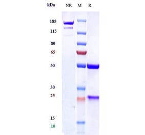 SDS-PAGE - Anti-VEGFC Antibody [VGX100] - Low endotoxin, Azide free (A324294) - Antibodies.com