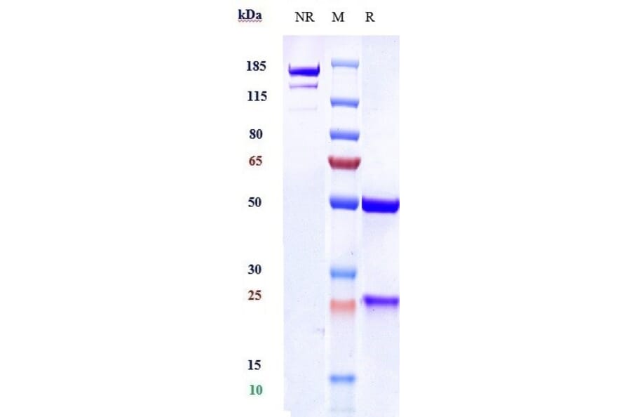 SDS-PAGE - Anti-VEGFC Antibody [VGX100] - Low endotoxin, Azide free (A324294) - Antibodies.com