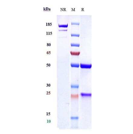 SDS-PAGE - Anti-VEGFC Antibody [VGX100] - Low endotoxin, Azide free (A324294) - Antibodies.com