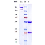 SDS-PAGE - Anti-VEGFC Antibody [VGX100] - Low endotoxin, Azide free (A324294) - Antibodies.com