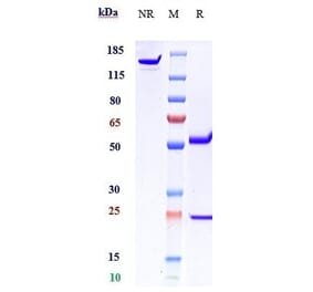 SDS-PAGE - Anti-Von Willebrand Factor Antibody [Research Grade Biosimilar] - Low endotoxin, Azide free (A324296) - Antibodies.com
