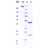 SDS-PAGE - Anti-ZNF354C Antibody [Research Grade Biosimilar] - Low endotoxin, Azide free (A324299) - Antibodies.com