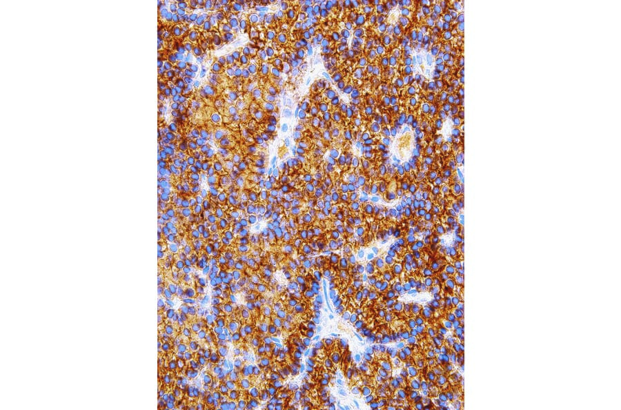 Immunohistochemistry - Anti-Parathyroid Hormone Antibody [IHC645] (A324380) - Antibodies.com