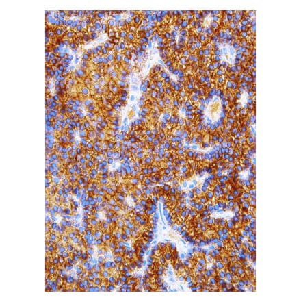 Immunohistochemistry - Anti-Parathyroid Hormone Antibody [IHC645] (A324380) - Antibodies.com