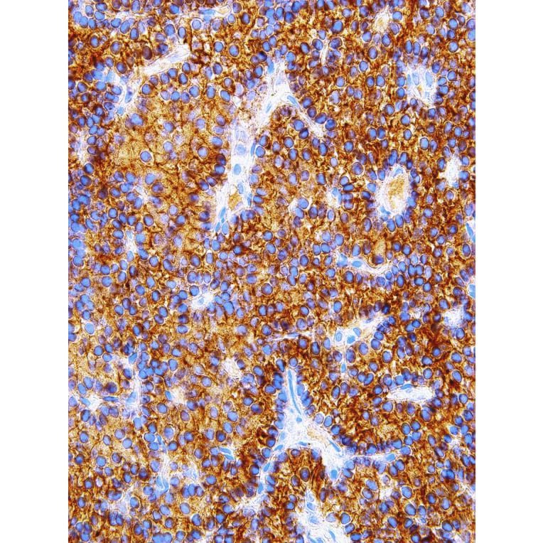 Immunohistochemistry - Anti-Parathyroid Hormone Antibody [IHC645] (A324380) - Antibodies.com