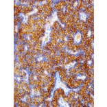 Immunohistochemistry - Anti-Parathyroid Hormone Antibody [IHC645] (A324380) - Antibodies.com