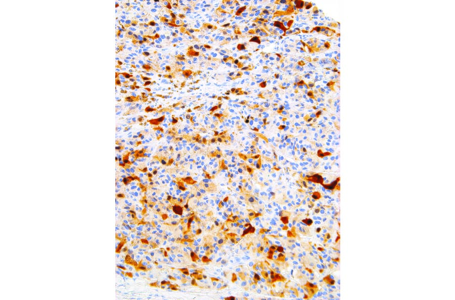 Immunohistochemistry - Anti-S100 alpha Antibody [IHC100] (A324381) - Antibodies.com
