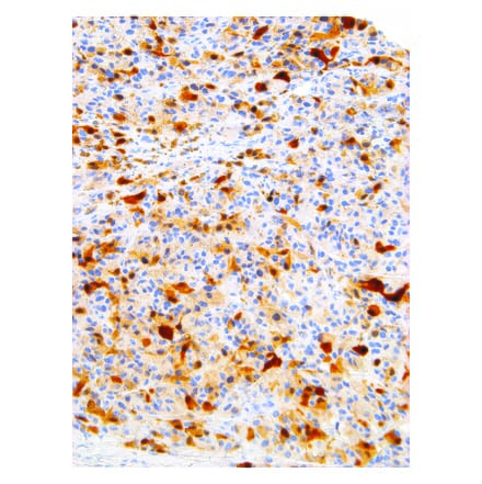 Immunohistochemistry - Anti-S100 alpha Antibody [IHC100] (A324381) - Antibodies.com