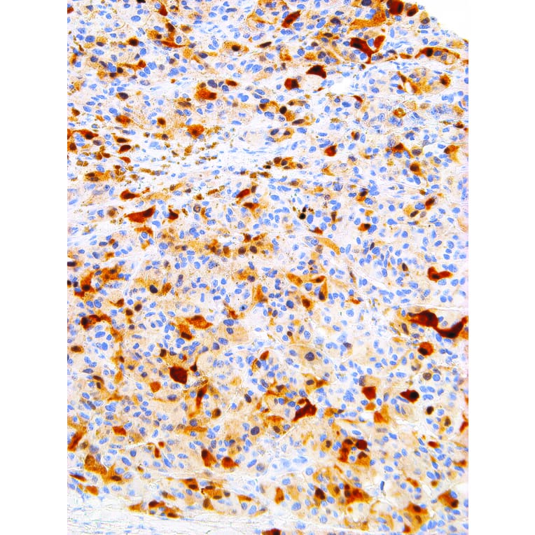 Immunohistochemistry - Anti-S100 alpha Antibody [IHC100] (A324381) - Antibodies.com