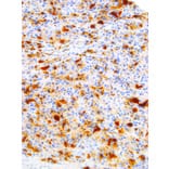 Immunohistochemistry - Anti-S100 alpha Antibody [IHC100] (A324381) - Antibodies.com