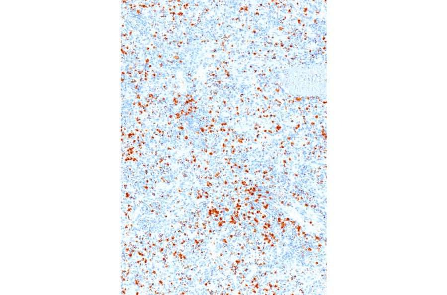 Immunohistochemistry - Anti-Perforin Antibody [IHC646] (A324382) - Antibodies.com