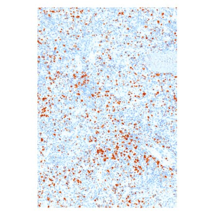 Immunohistochemistry - Anti-Perforin Antibody [IHC646] (A324382) - Antibodies.com