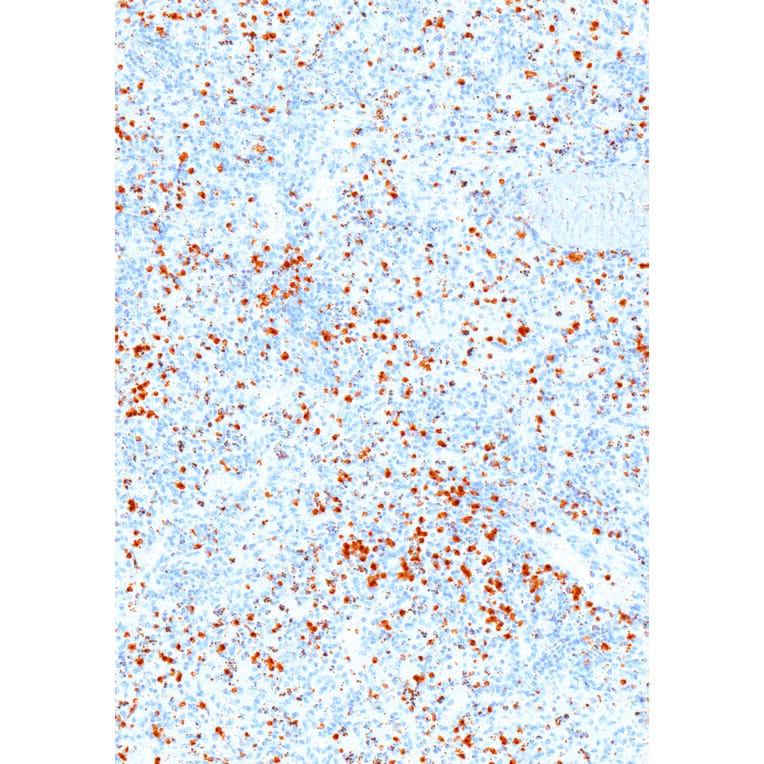 Immunohistochemistry - Anti-Perforin Antibody [IHC646] (A324382) - Antibodies.com