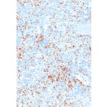 Immunohistochemistry - Anti-Perforin Antibody [IHC646] (A324382) - Antibodies.com