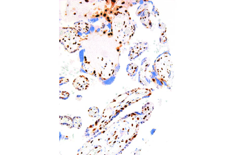Immunohistochemistry - Anti-p57 Kip2 Antibody [IHC057] (A324383) - Antibodies.com