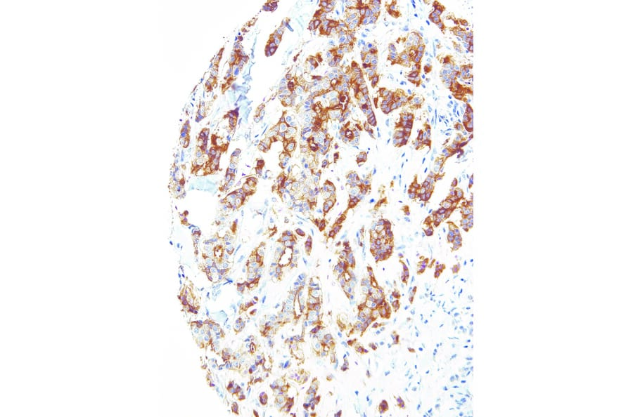 Immunohistochemistry - Anti-B7H4 Antibody [IHC104] (A324385) - Antibodies.com