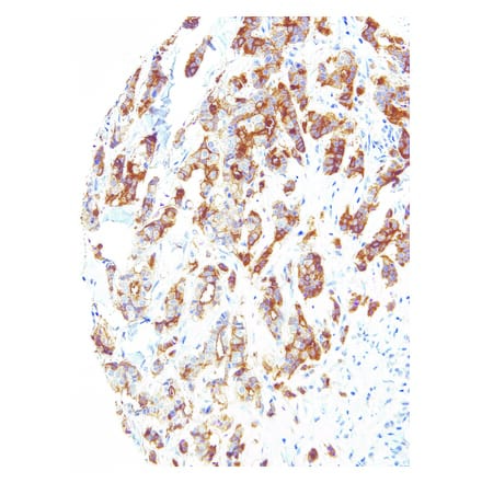 Immunohistochemistry - Anti-B7H4 Antibody [IHC104] (A324385) - Antibodies.com