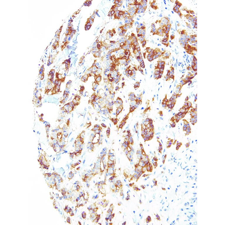Immunohistochemistry - Anti-B7H4 Antibody [IHC104] (A324385) - Antibodies.com