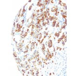 Immunohistochemistry - Anti-B7H4 Antibody [IHC104] (A324385) - Antibodies.com