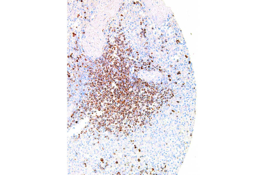 Immunohistochemistry - Anti-TIGIT Antibody [IHC269] (A324390) - Antibodies.com