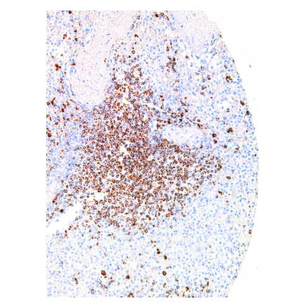 Immunohistochemistry - Anti-TIGIT Antibody [IHC269] (A324390) - Antibodies.com