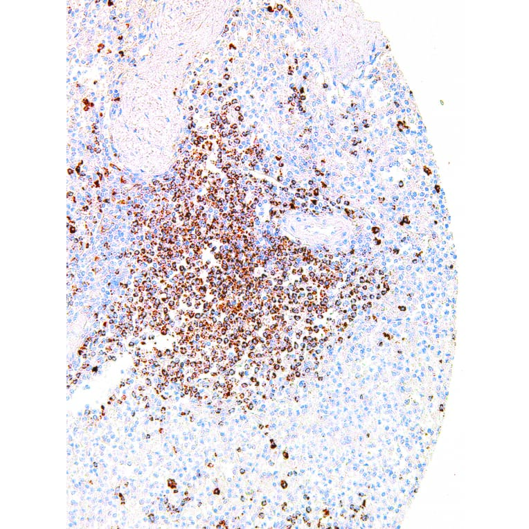 Immunohistochemistry - Anti-TIGIT Antibody [IHC269] (A324390) - Antibodies.com