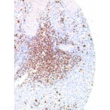 Immunohistochemistry - Anti-TIGIT Antibody [IHC269] (A324390) - Antibodies.com