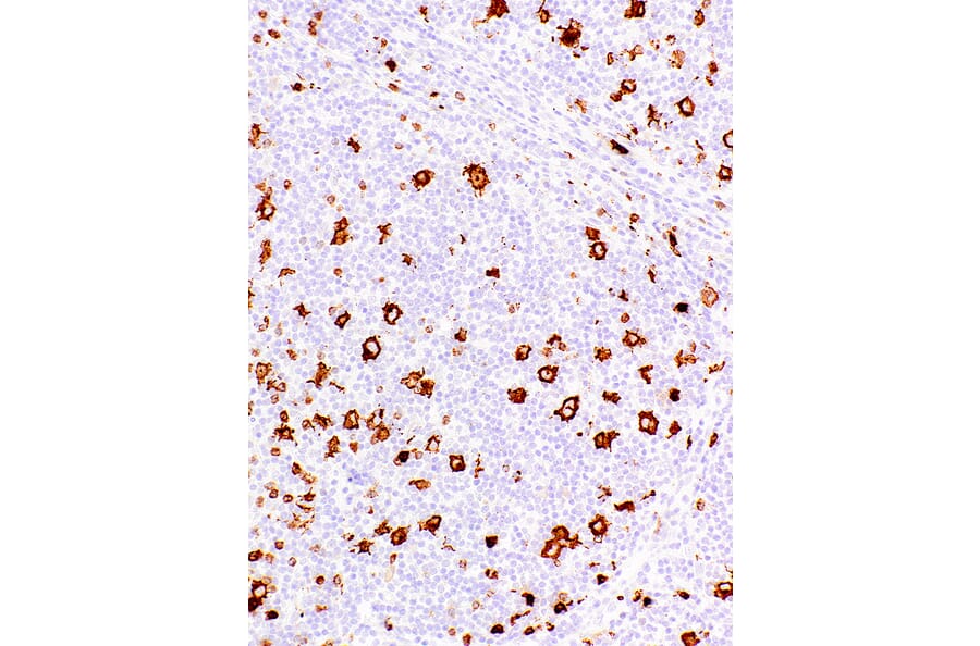 Immunohistochemistry - Anti-CD15 Antibody [IHC527] (A324393) - Antibodies.com