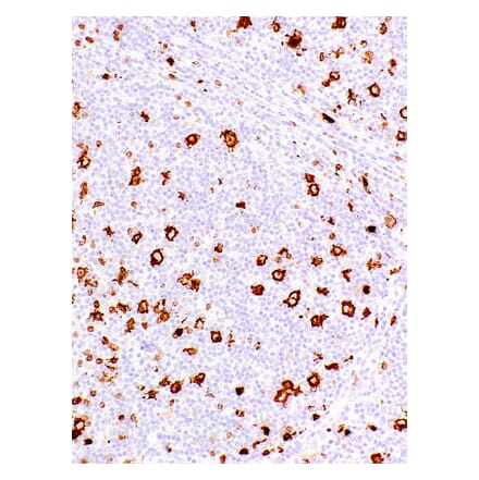 Immunohistochemistry - Anti-CD15 Antibody [IHC527] (A324393) - Antibodies.com