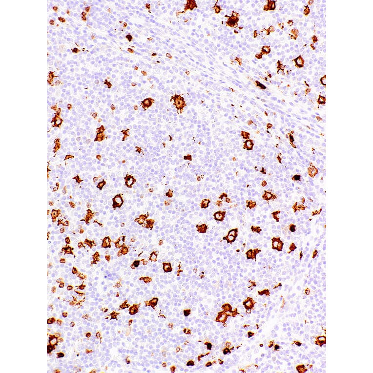 Immunohistochemistry - Anti-CD15 Antibody [IHC527] (A324393) - Antibodies.com