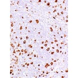 Immunohistochemistry - Anti-CD15 Antibody [IHC527] (A324393) - Antibodies.com