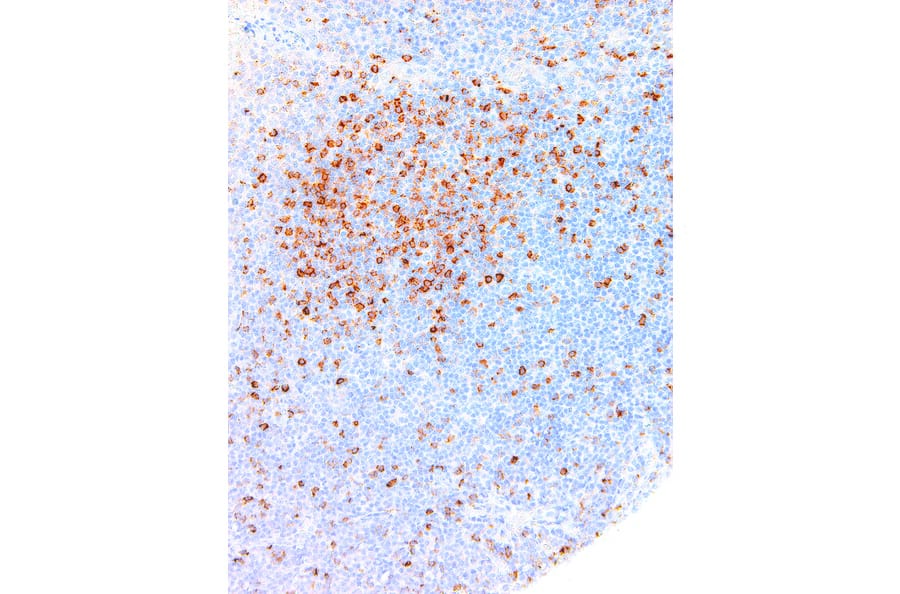 Immunohistochemistry - Anti-Hairy Cell Leukemia Antibody [IHC687] (A324394) - Antibodies.com
