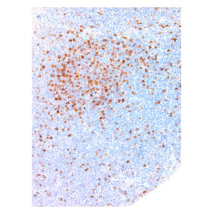 Immunohistochemistry - Anti-Hairy Cell Leukemia Antibody [IHC687] (A324394) - Antibodies.com