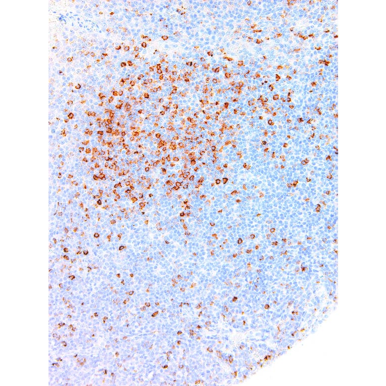 Immunohistochemistry - Anti-Hairy Cell Leukemia Antibody [IHC687] (A324394) - Antibodies.com
