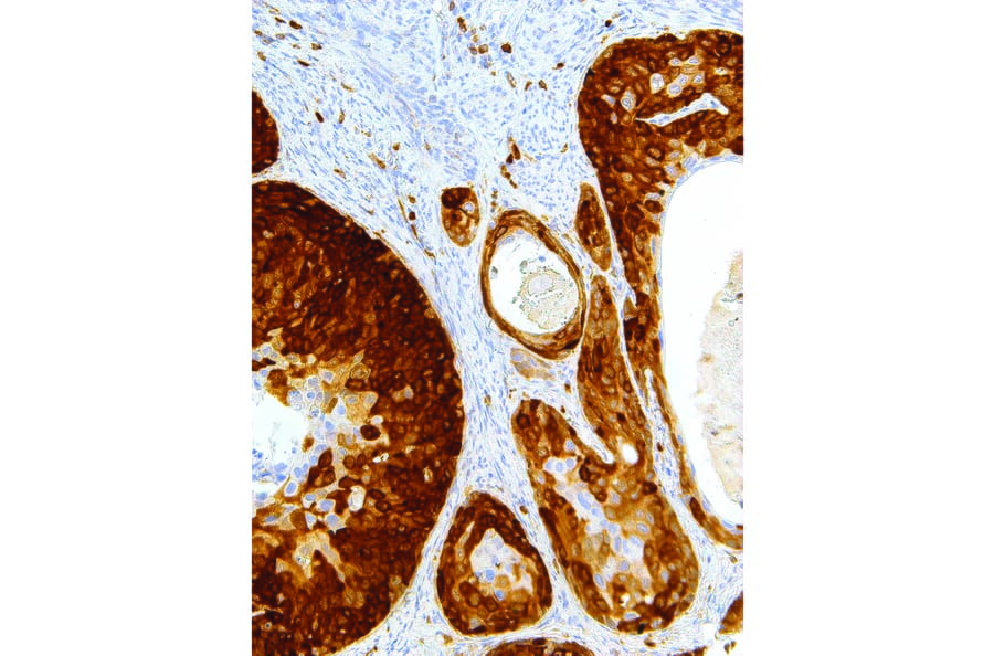 Immunohistochemistry - Anti-Stathmin 1 Antibody [IHC667] (A324396) - Antibodies.com