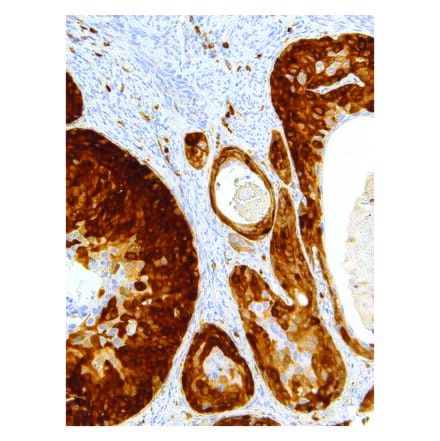 Immunohistochemistry - Anti-Stathmin 1 Antibody [IHC667] (A324396) - Antibodies.com