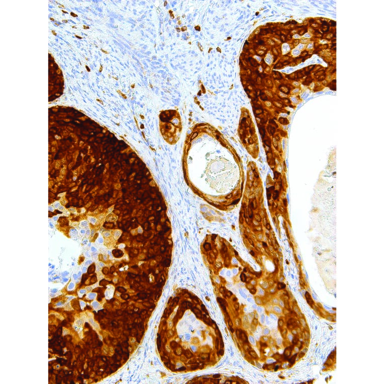 Immunohistochemistry - Anti-Stathmin 1 Antibody [IHC667] (A324396) - Antibodies.com