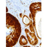 Immunohistochemistry - Anti-Stathmin 1 Antibody [IHC667] (A324396) - Antibodies.com