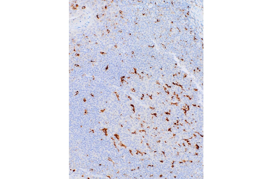 Immunohistochemistry - Anti-CD68 Antibody [IHC068] (A324397) - Antibodies.com
