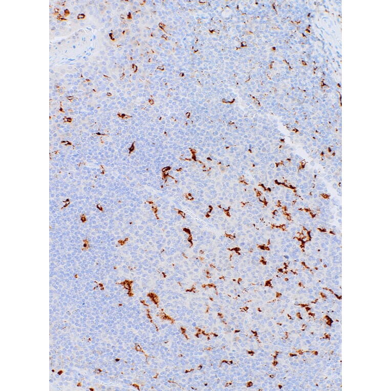 Immunohistochemistry - Anti-CD68 Antibody [IHC068] (A324397) - Antibodies.com