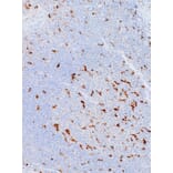 Immunohistochemistry - Anti-CD68 Antibody [IHC068] (A324397) - Antibodies.com