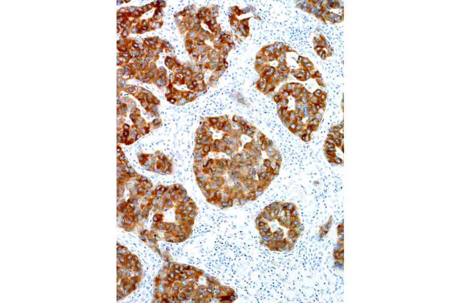 Immunohistochemistry - Anti-ALK Antibody [IHC509] (A324398) - Antibodies.com