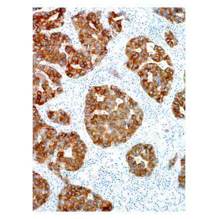 Immunohistochemistry - Anti-ALK Antibody [IHC509] (A324398) - Antibodies.com