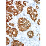 Immunohistochemistry - Anti-ALK Antibody [IHC509] (A324398) - Antibodies.com