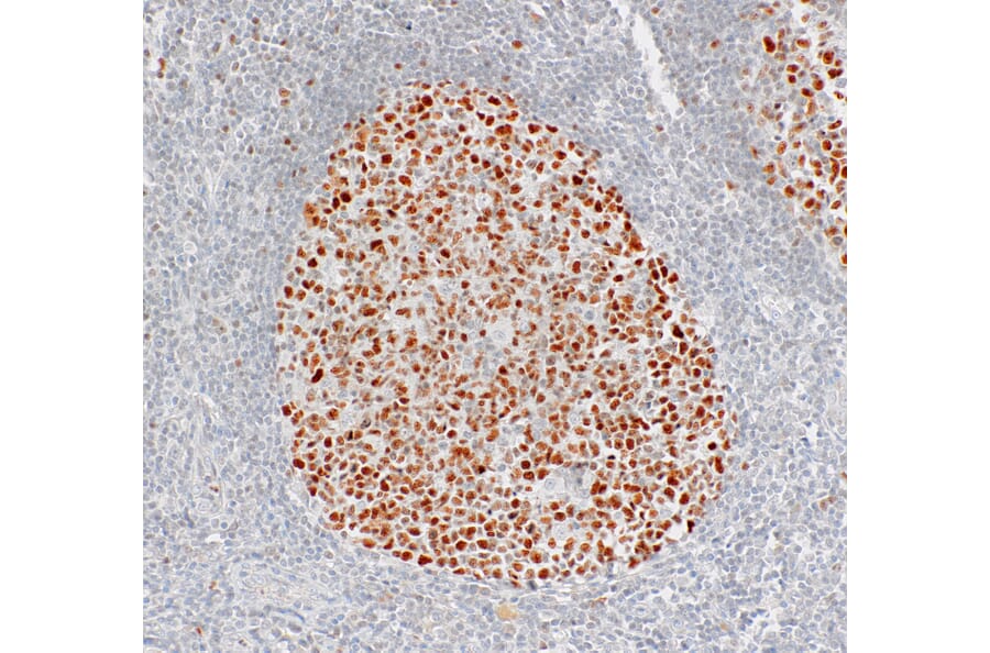 Immunohistochemistry - Anti-Bcl6 Antibody [IHC029] (A324399) - Antibodies.com